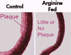 arteries_arginine_fed_250